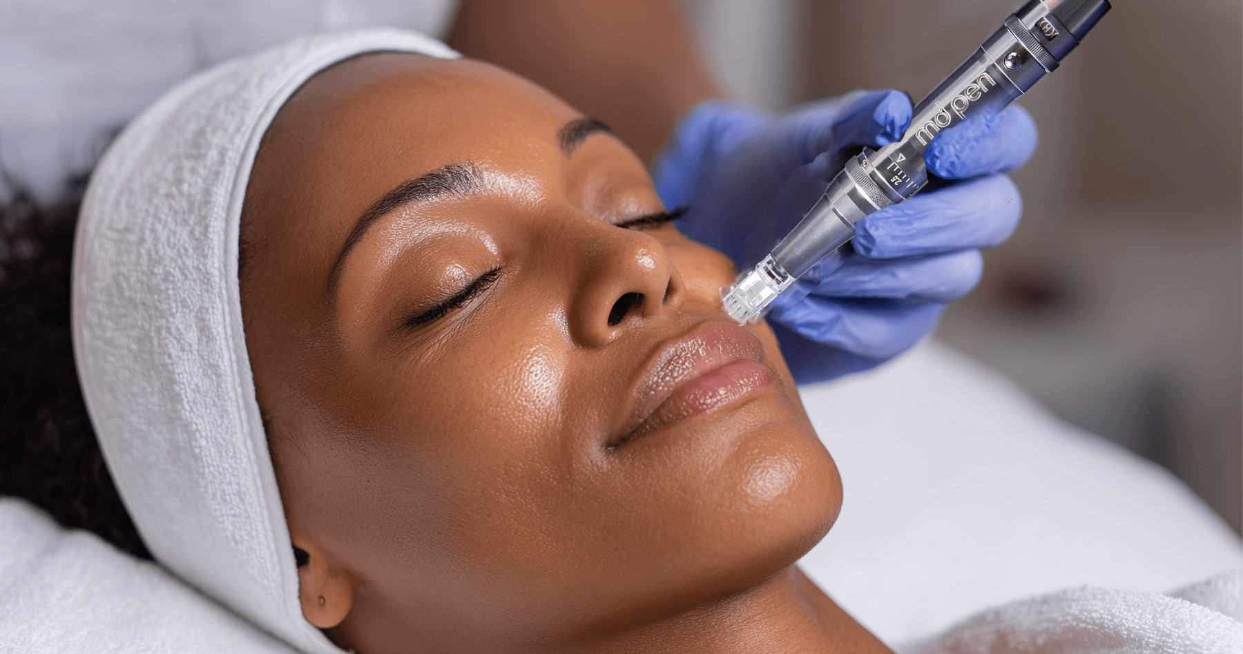 Microneedling Black Skin NYC