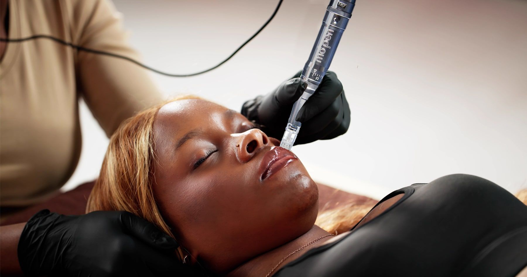 Microneedling Treatment for Black Skin NYC
