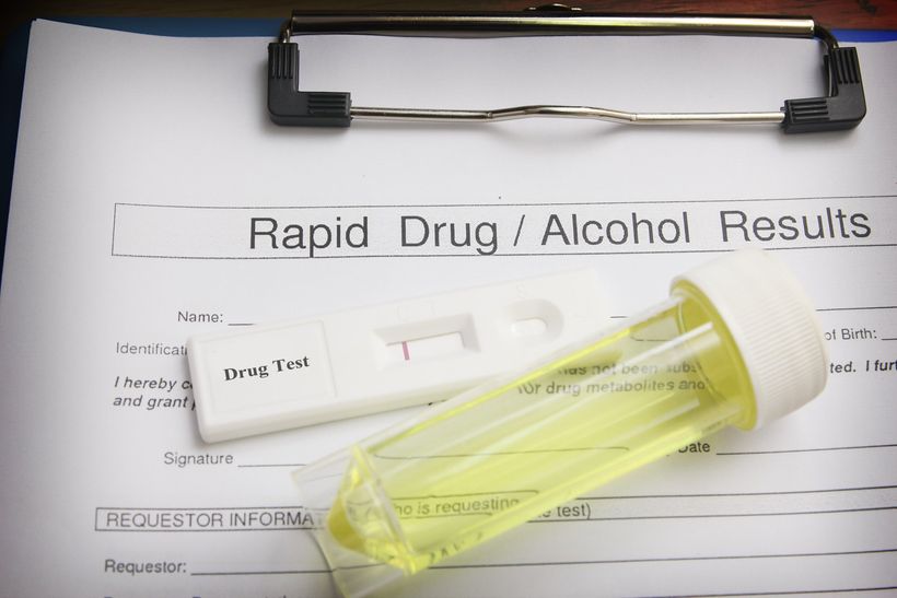 Drug test blank form with test kit and urine,focus on paper