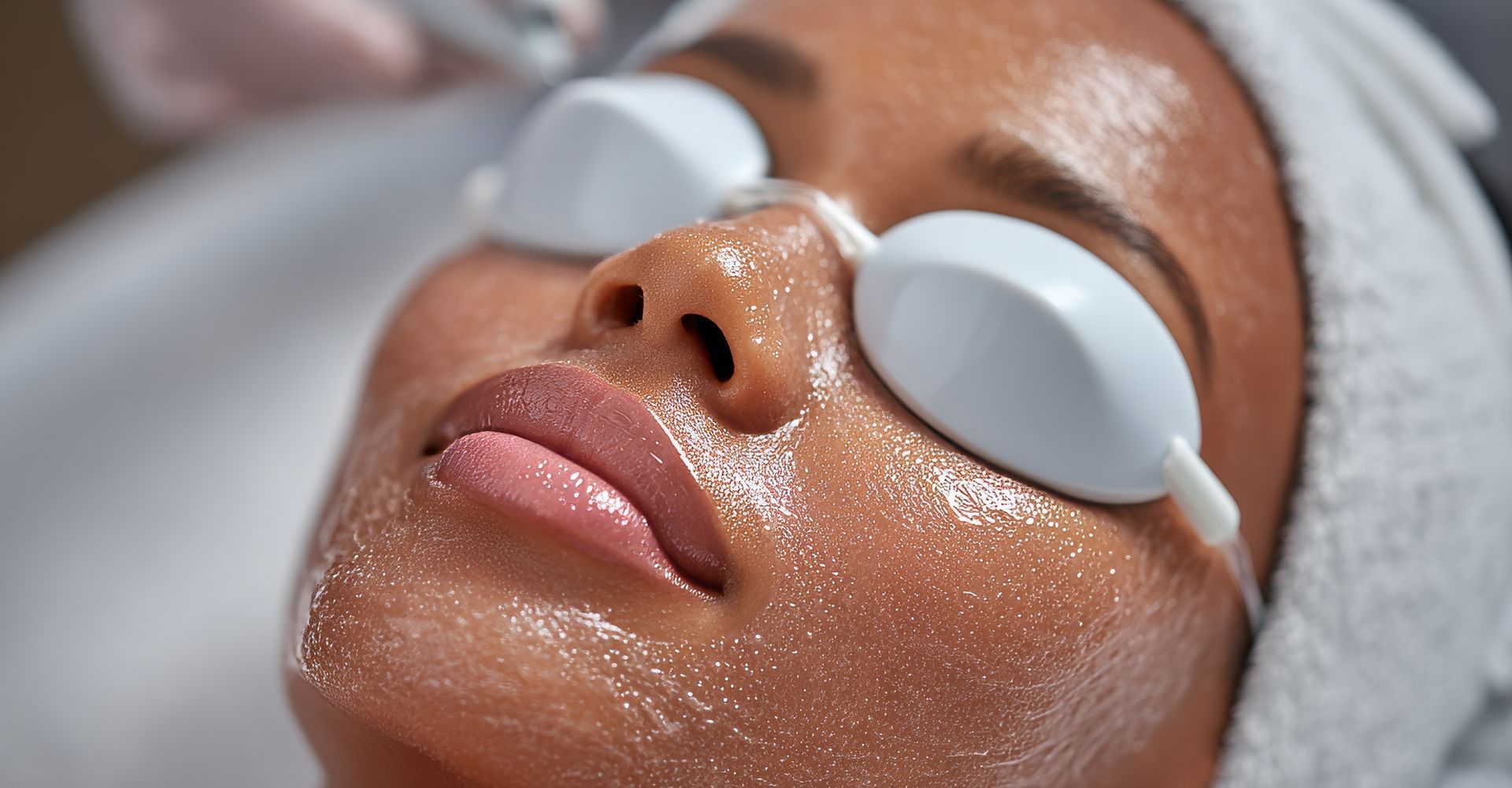 Close-up of a person's face wearing protective eyewear, receiving skincare treatment in a spa-like setting.