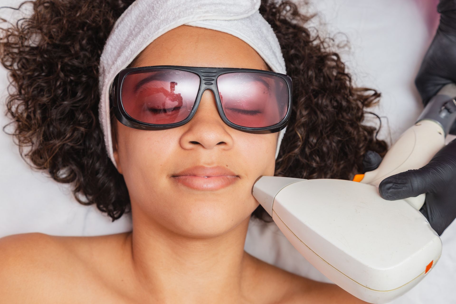 Woman wearing protective eyewear receiving facial laser treatment.