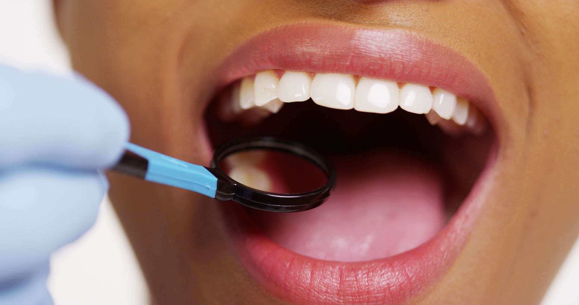 Close-up of a woman’s mouth as she smiles, as a dentist tool checks her mouth. Close-up of a woman’s mouth as she smiles, as a dentist tool checks her mouth.