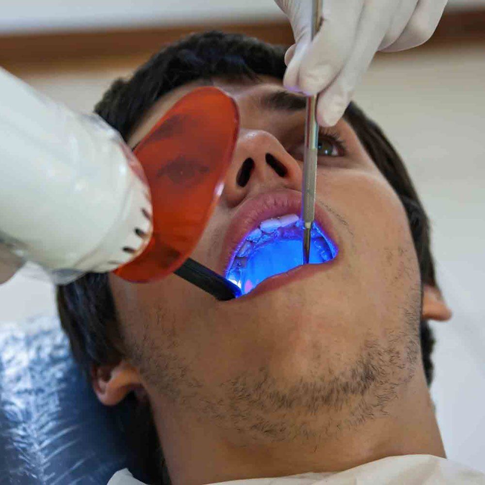 Root Canal Checking — Portage, IN — Airport Road Dental Associates, PC