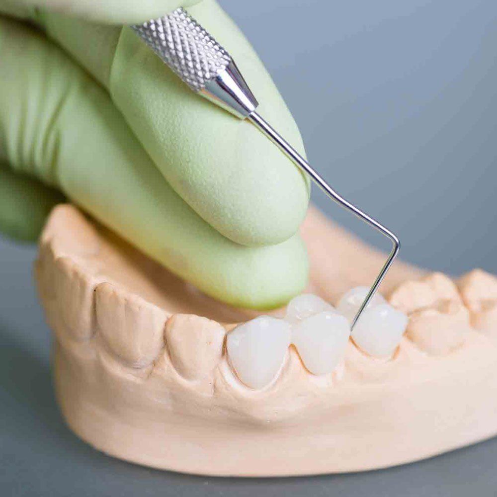 A Clay Denture — Portage, IN — Airport Road Dental Associates, PC