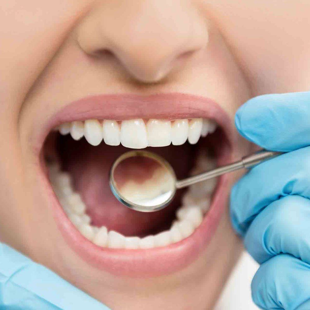Checking Teeth — Portage, IN — Airport Road Dental Associates, PC