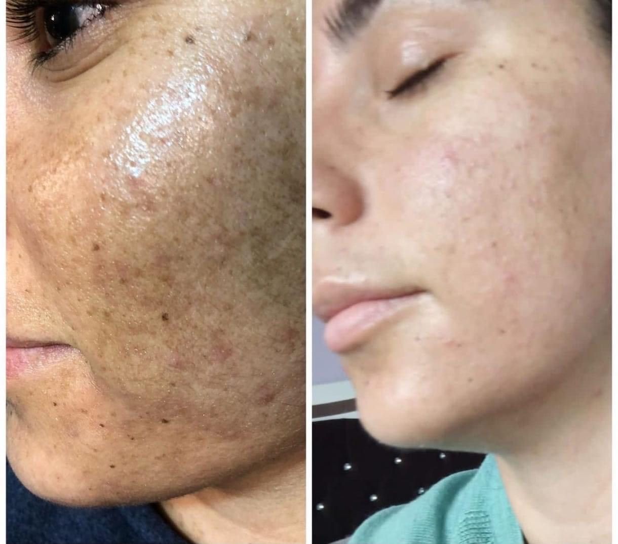 Rebecca Schneeberger Harmony Castle - Algenpeeling