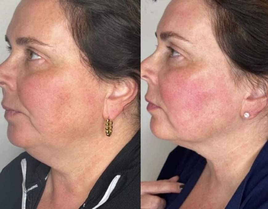 Rebecca Schneeberger Harmony Castle - Gesichtsbehandlung