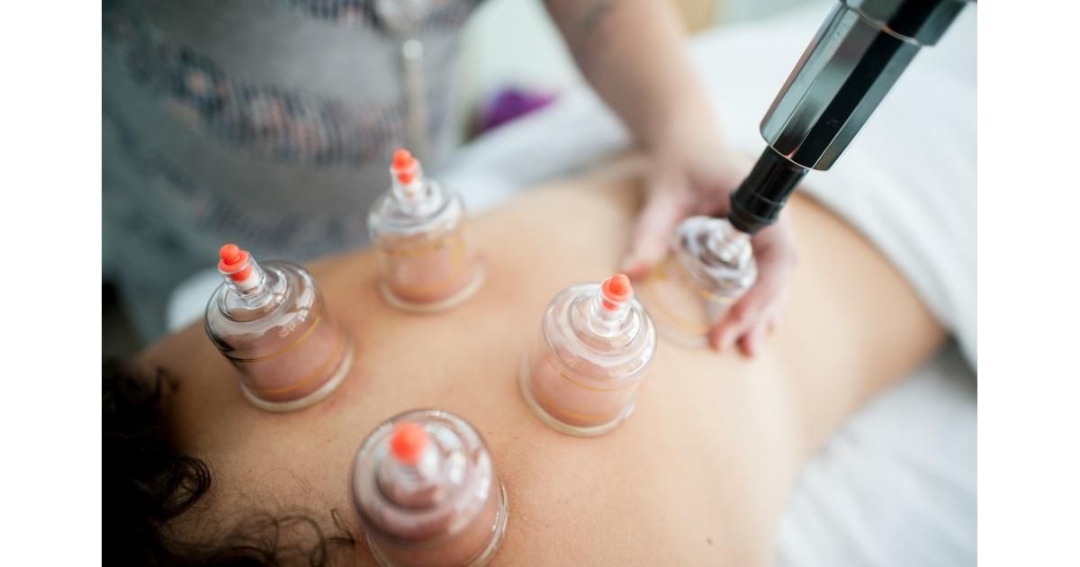 A person receives cupping therapy with plastic cups on their back, while a practitioner uses a handheld vacuum pump.