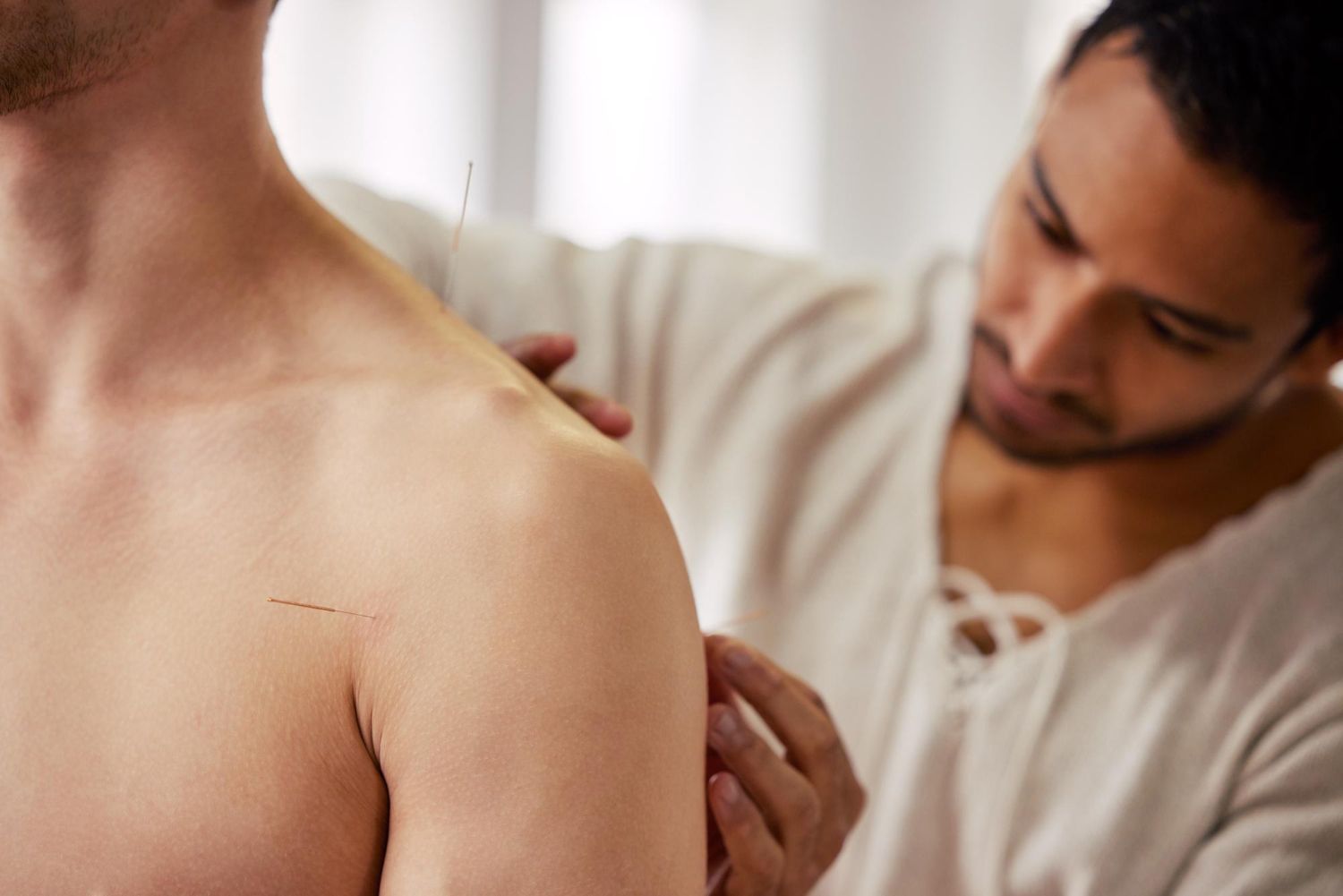 A practitioner performs acupuncture, inserting a thin needle into a patient's upper shoulder area.
