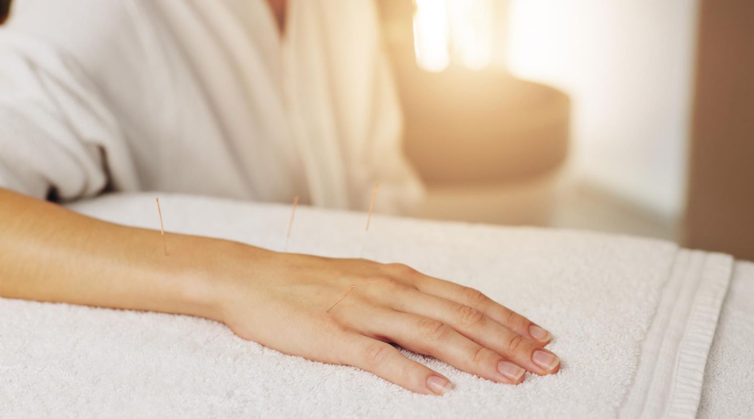 A person lying on a table receiving acupuncture with needles placed in their arm.
