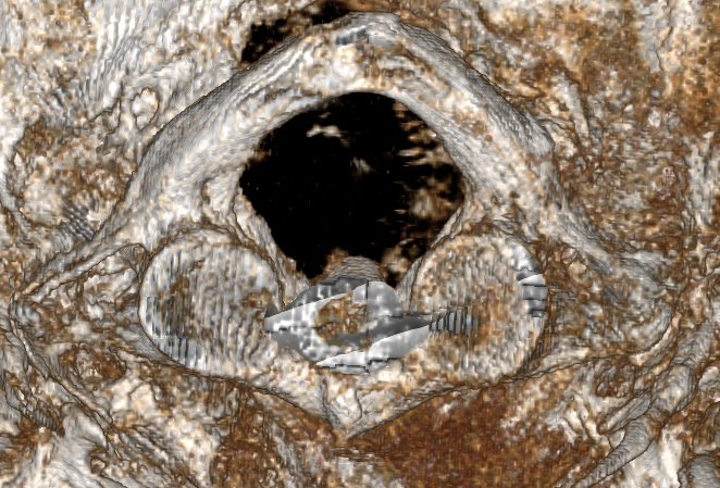 A close up of a rock with a hole in it.