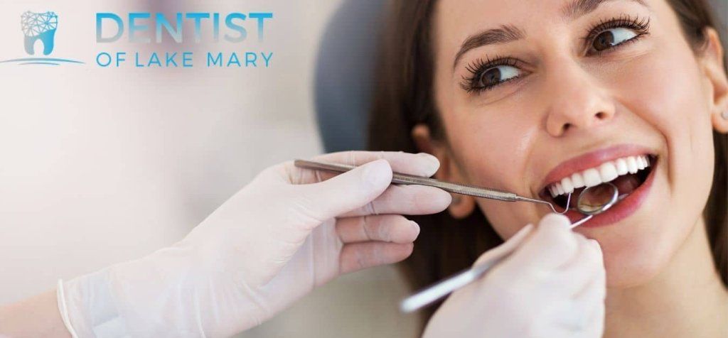 What You Should Know About Teeth Whitening in Lake Mary