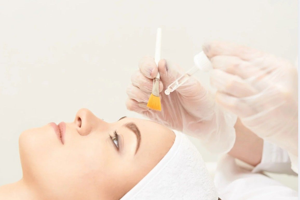 Client having an glycolic acid peel