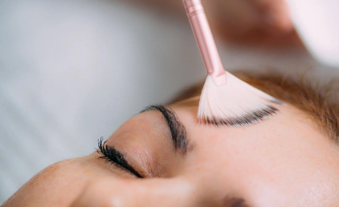 Client having an Mandelic acid peel