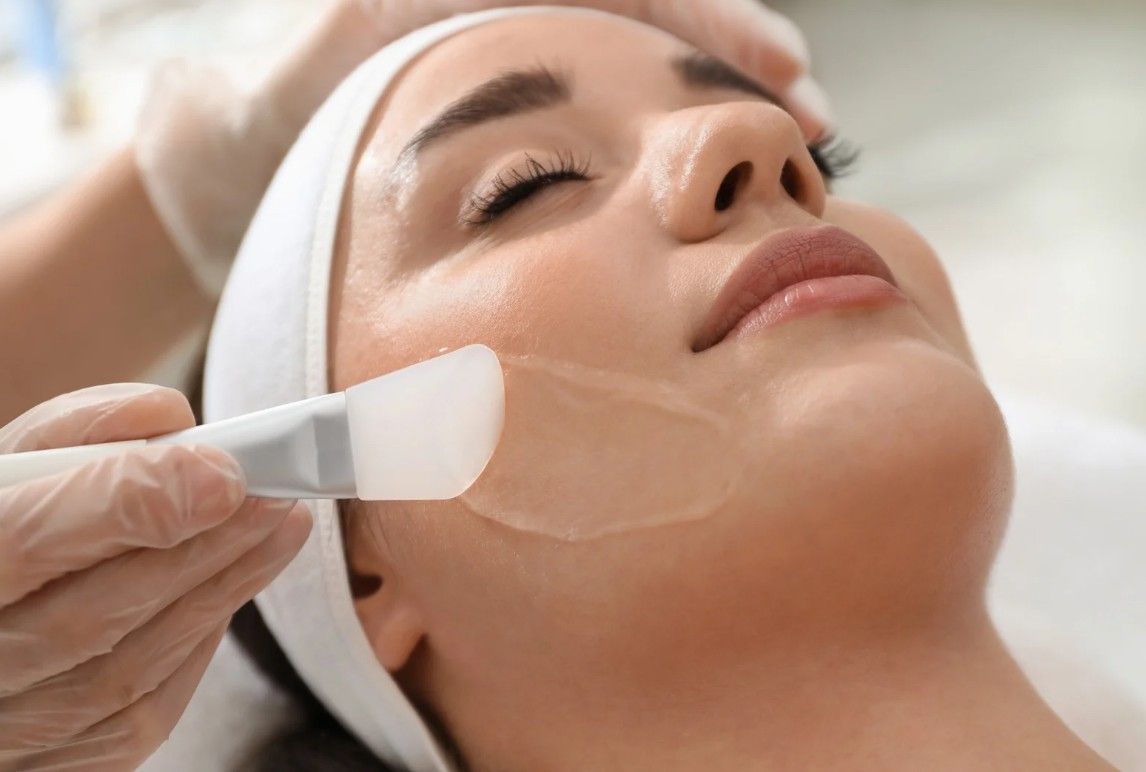 Client having an azelaic acid peel