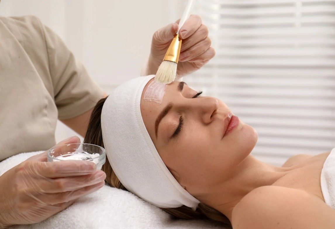 Client having an lactic acid peel