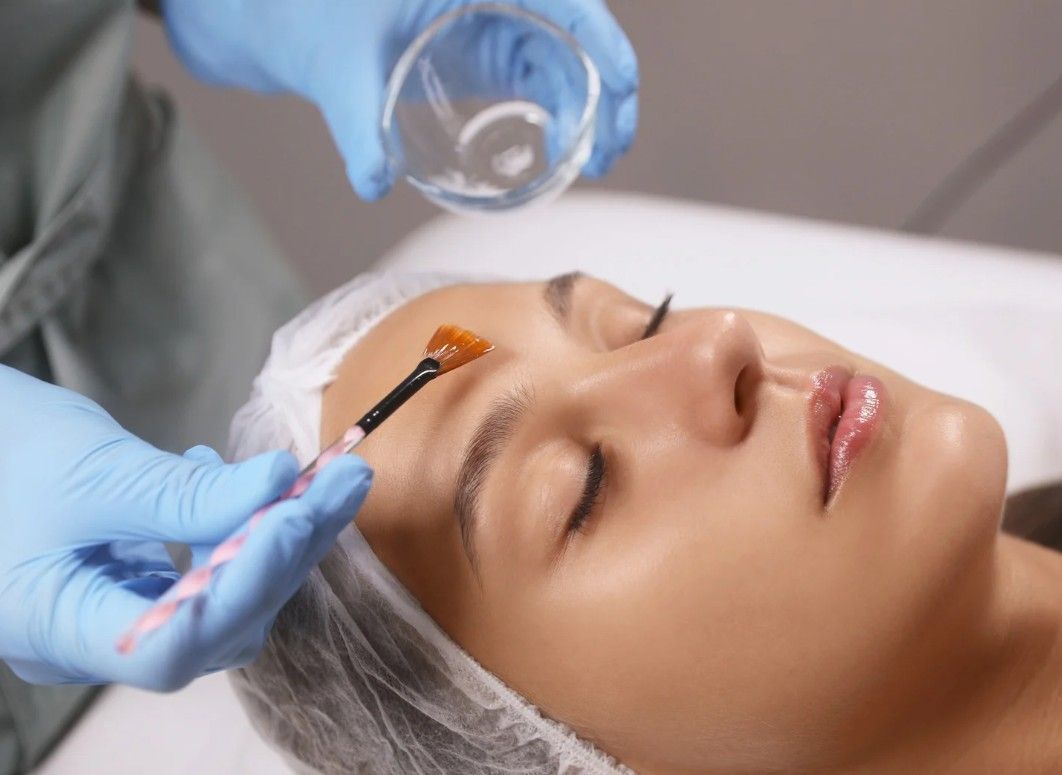 The Skin Studio applying a chemical peel to a client's face in Nottignham