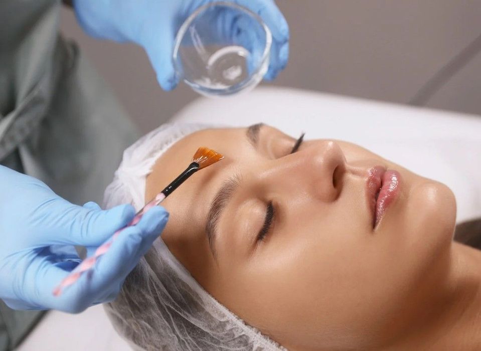 The Skin Studio applying a chemical peel to a client's face in Nottignham