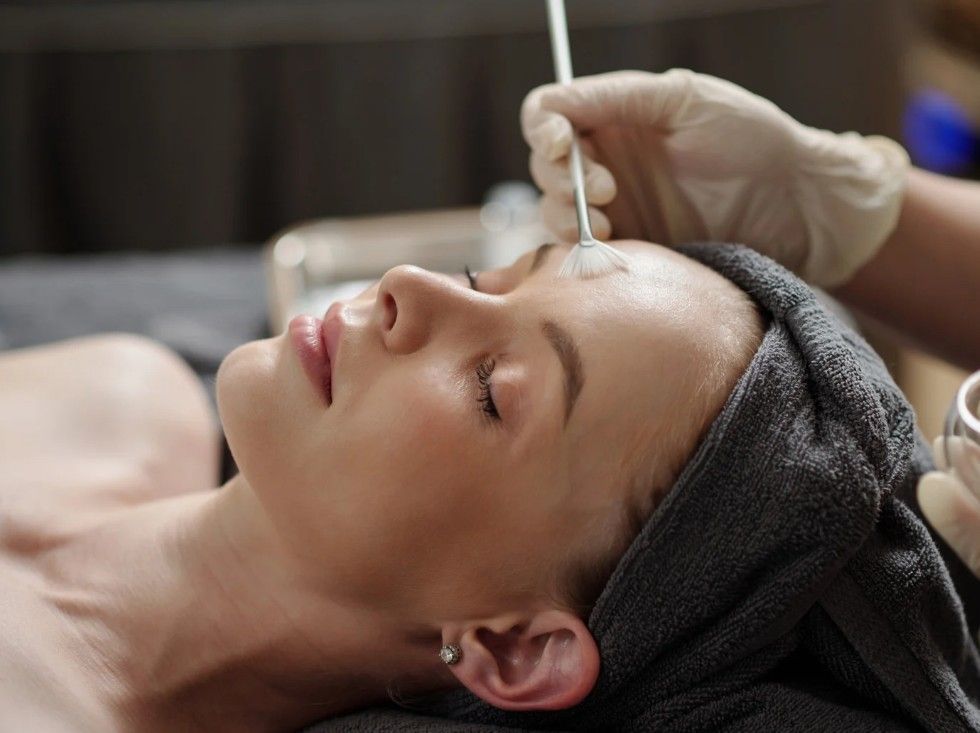 Client having a salicylic acid peel