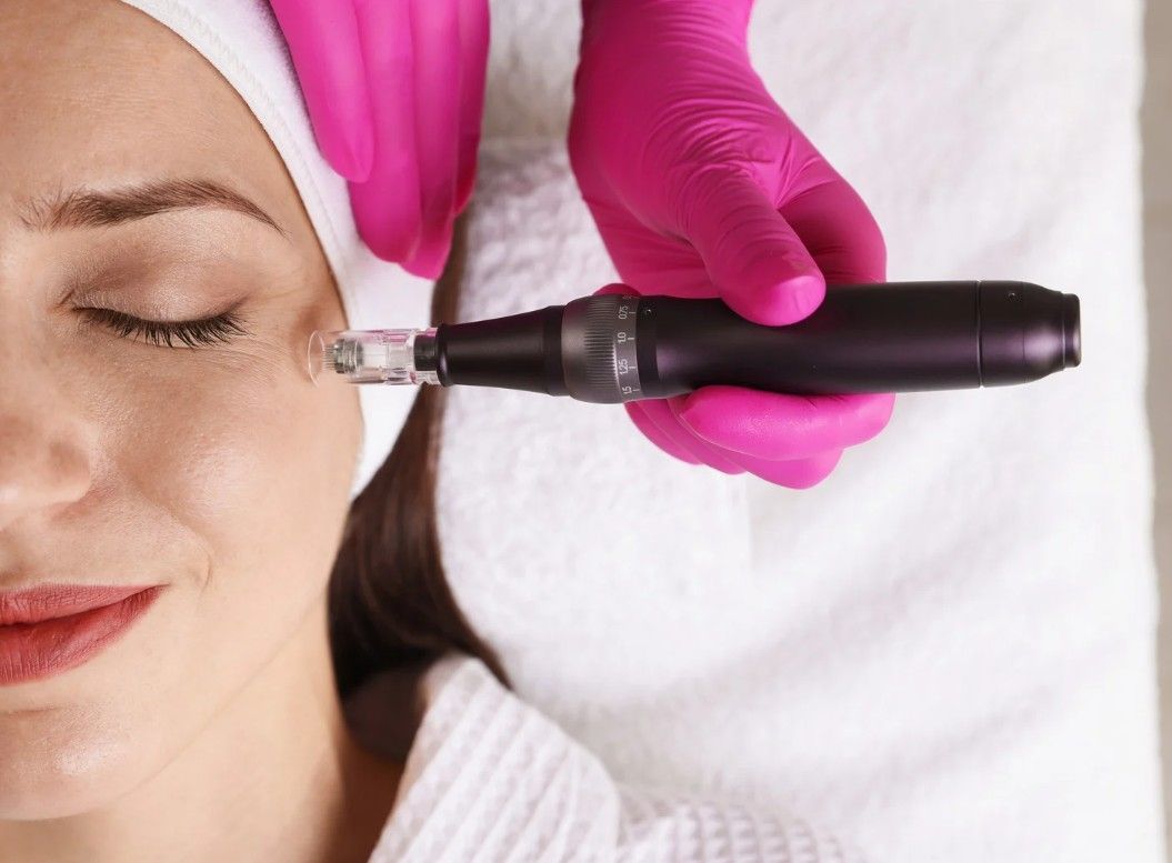 The Skin Studio microneedling a female client with a SkinPen 