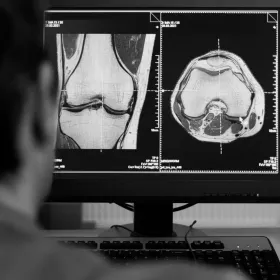 Une image en noir et blanc d’un genou sur un écran d’ordinateur