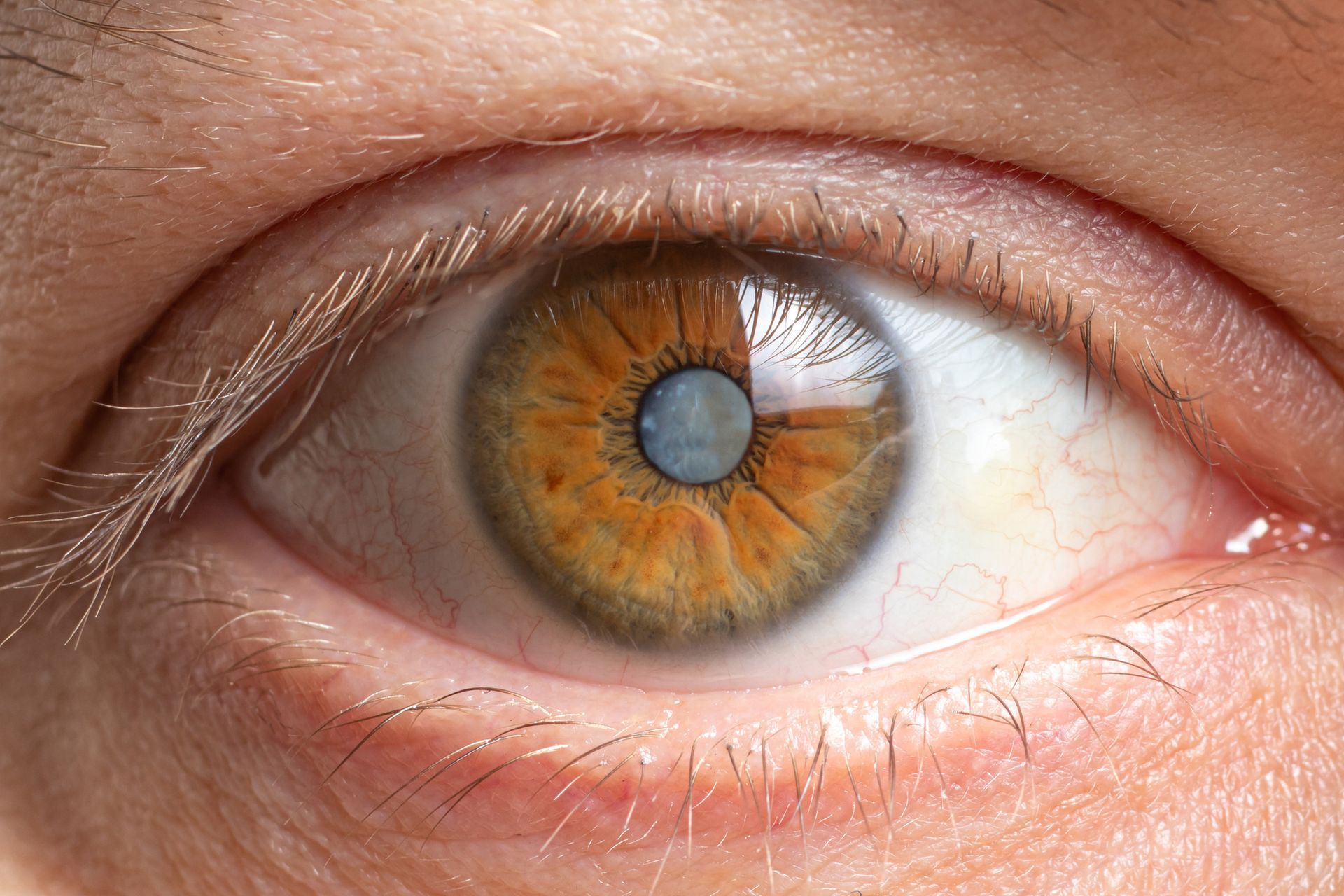 Macro human eye photo showcasing eye diseases treatment for cataracts and vision issues.