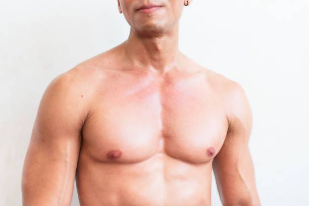 Pec implant surgery in Beverly Hills