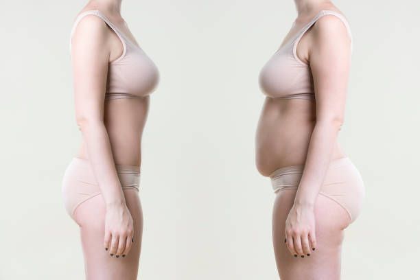 A before and after picture of a woman 's stomach.