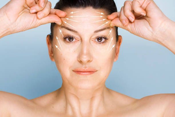 Forehead Reduction Surgery in Beverly Hills