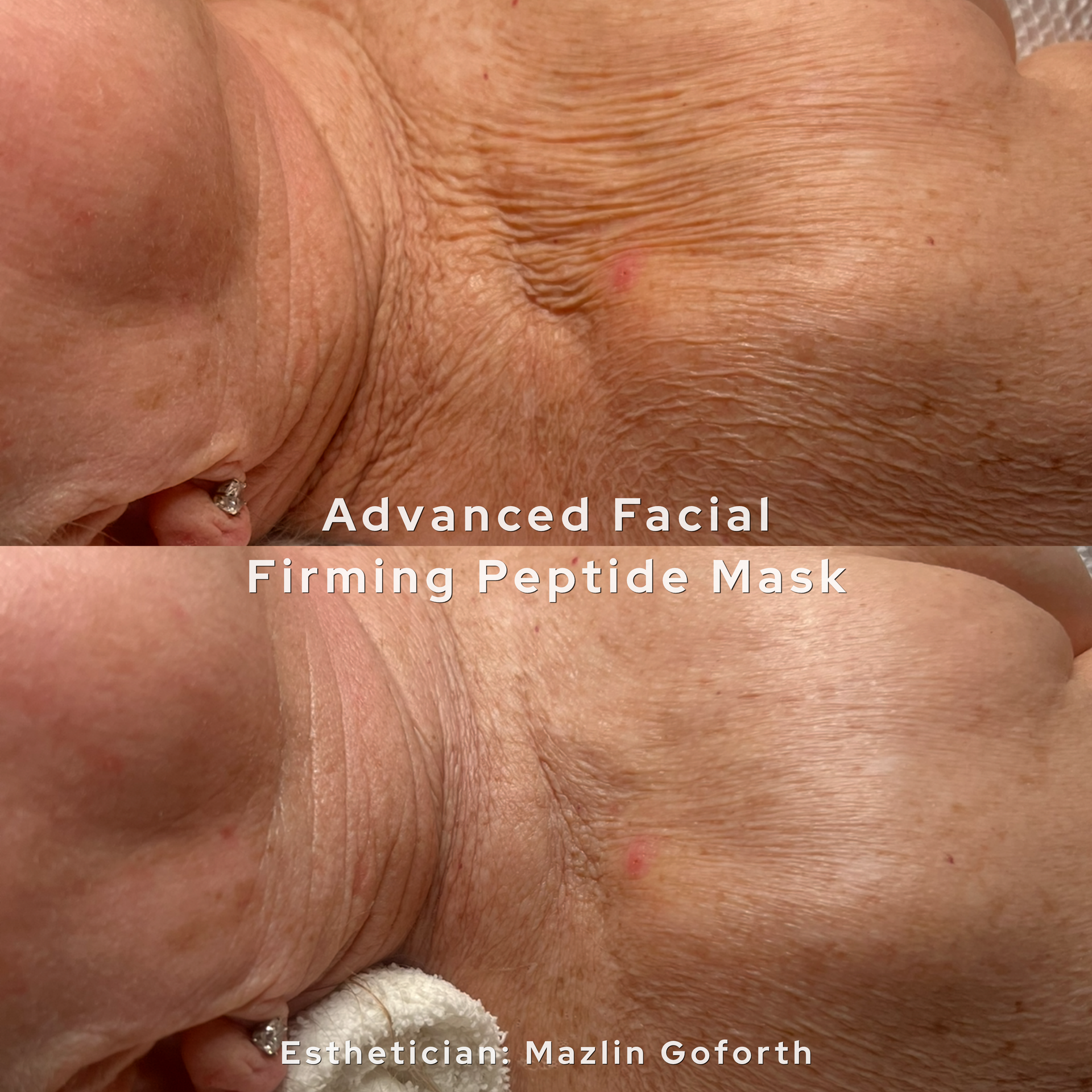 Advanced facial before and after at AesTonic Med Spa Oklahoma City