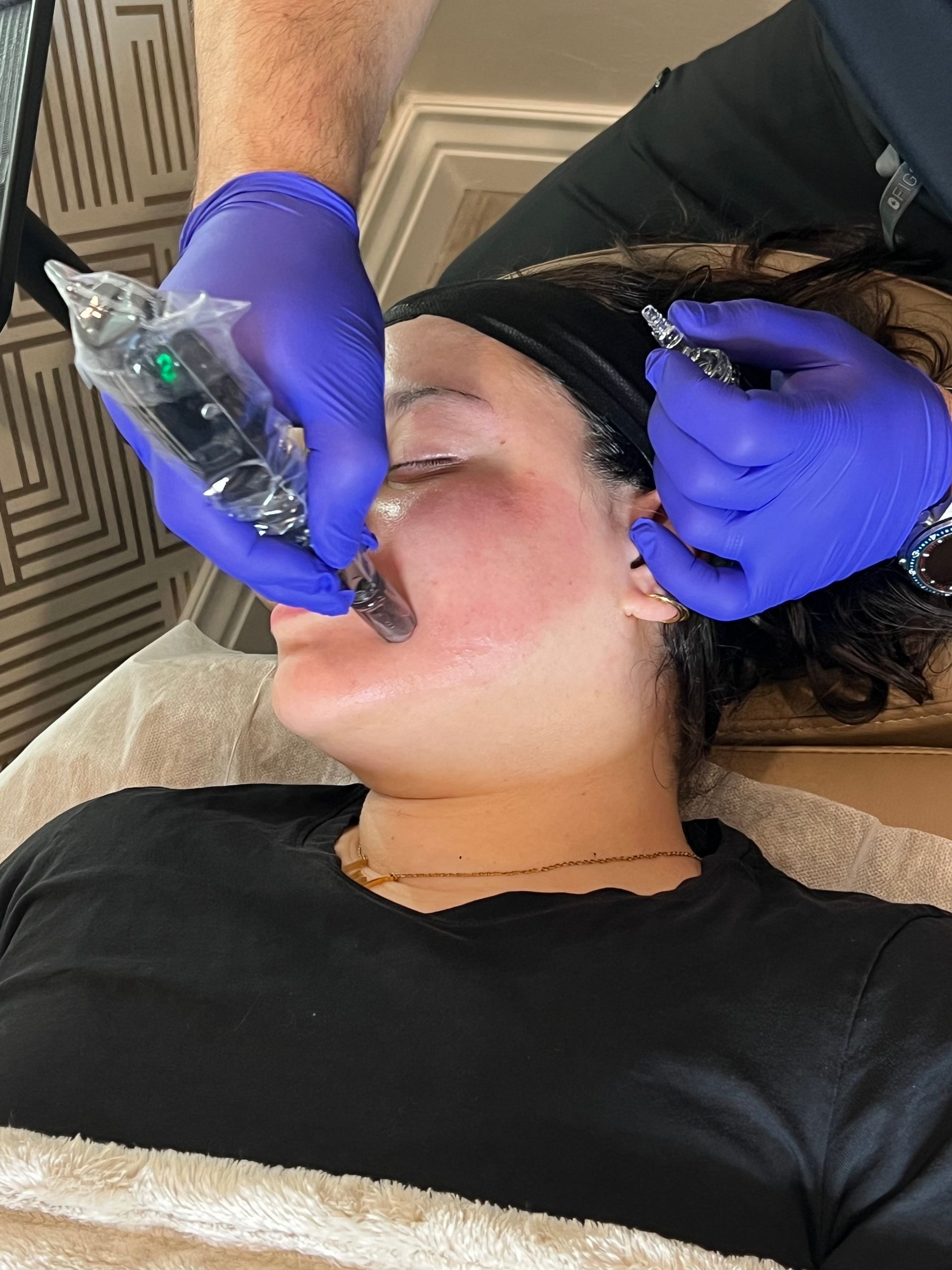Advanced microneedling add-ons at AesTonic Med Spa in Oklahoma City and Edmond