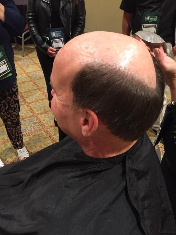 Man with a horseshoe-shaped hairstyle, getting a haircut.