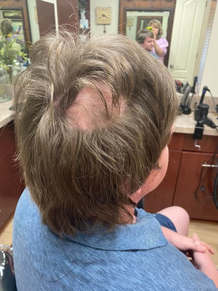 A person with short, brown hair in a salon chair, revealing a bald spot on the scalp.