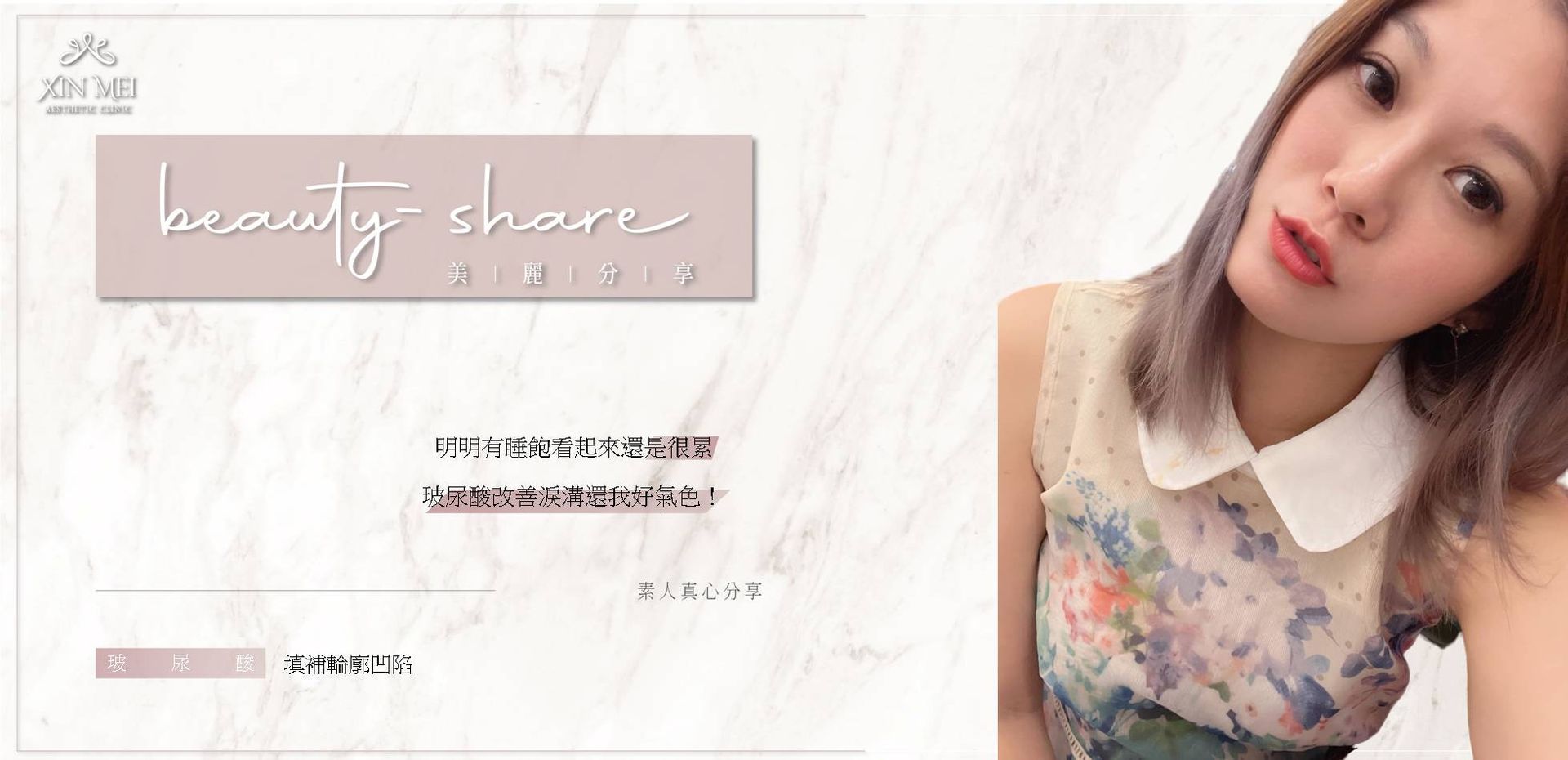 【分享】素人真心分享 ｜玻尿酸填淚溝