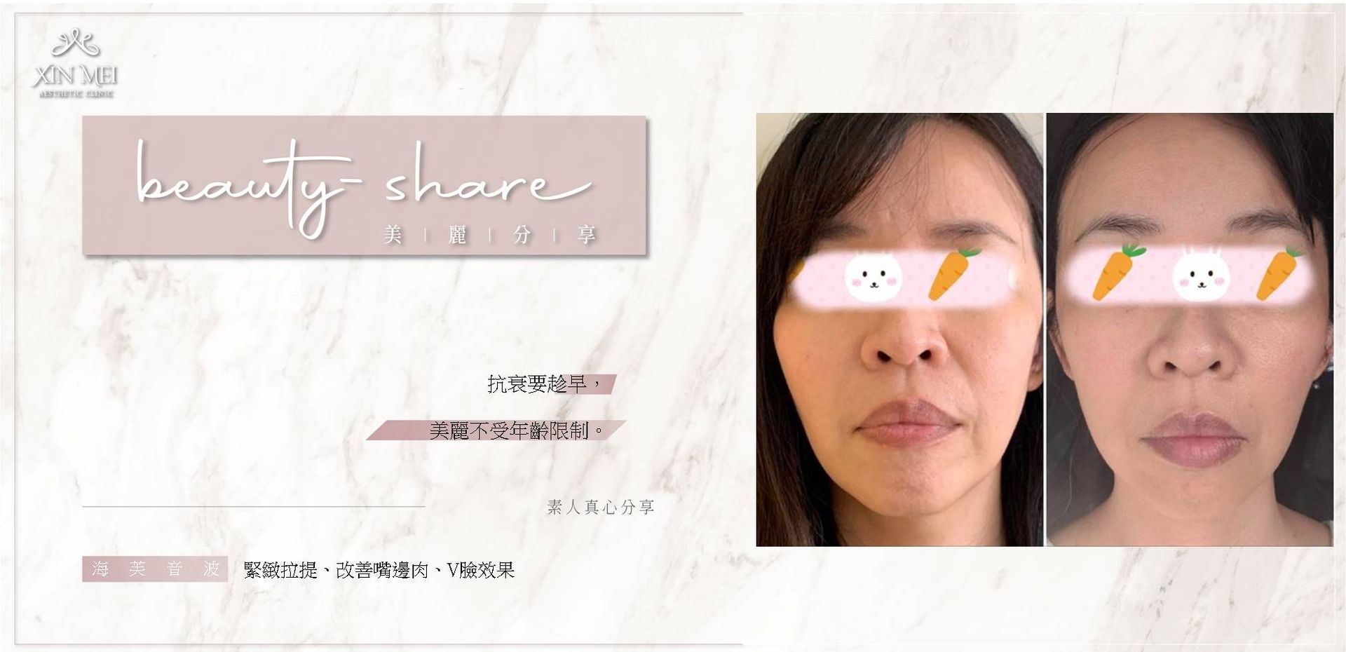 【分享】素人真心分享 ｜海芙音波