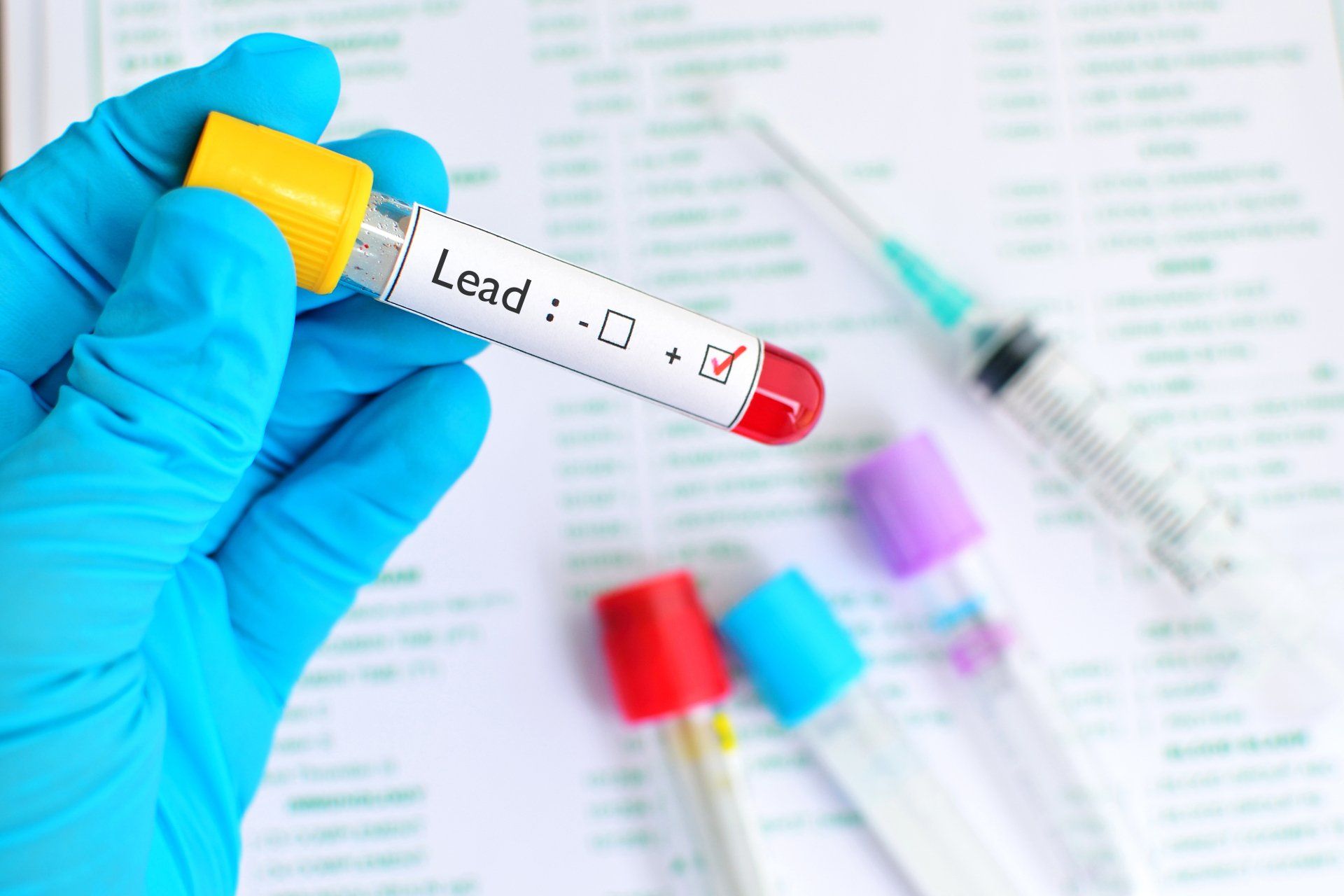 Test Tube Marked Positive For Lead Contamination