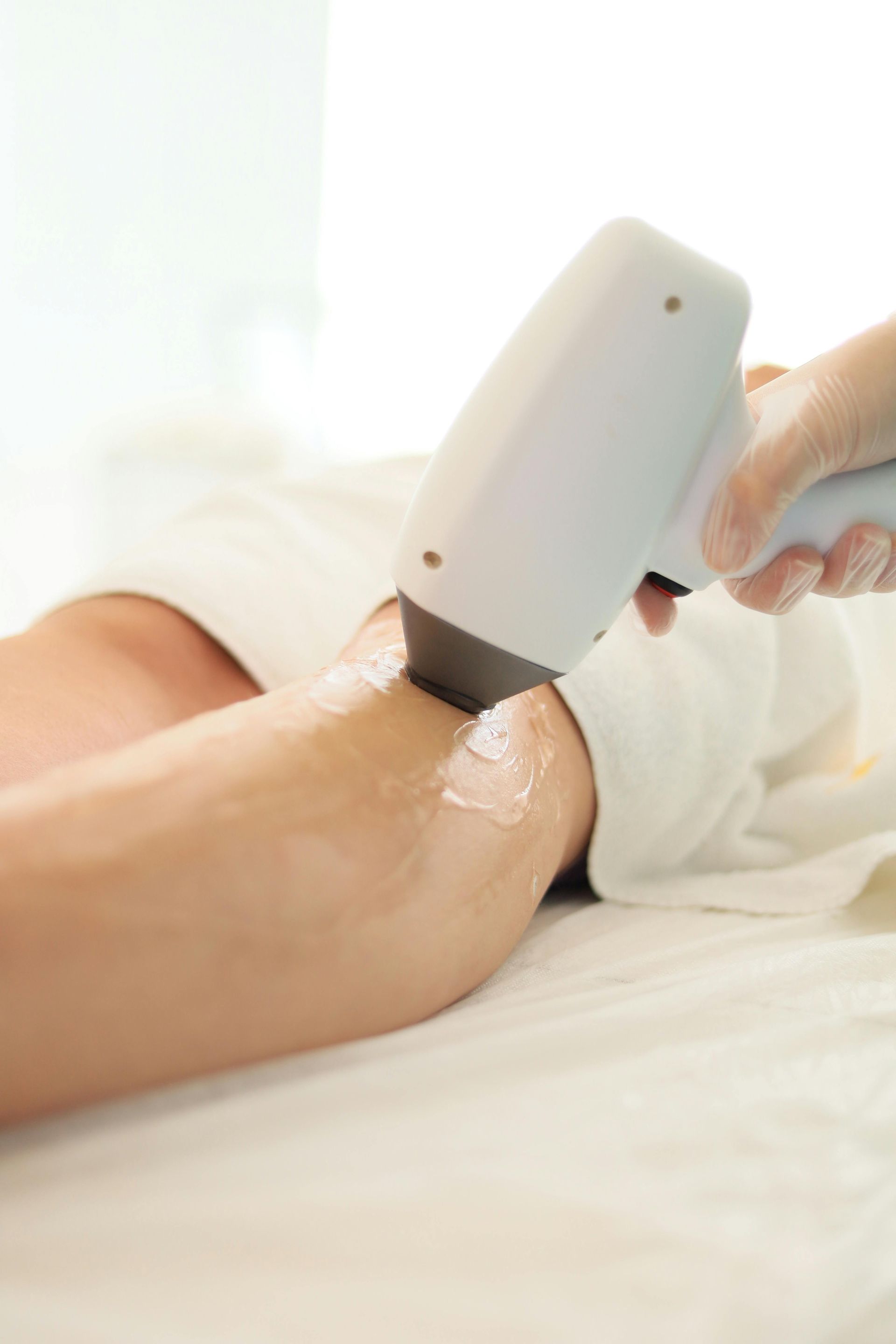 Leg receiving laser hair removal treatment. A leg is coated with gel, and a technician holds the laser device.
