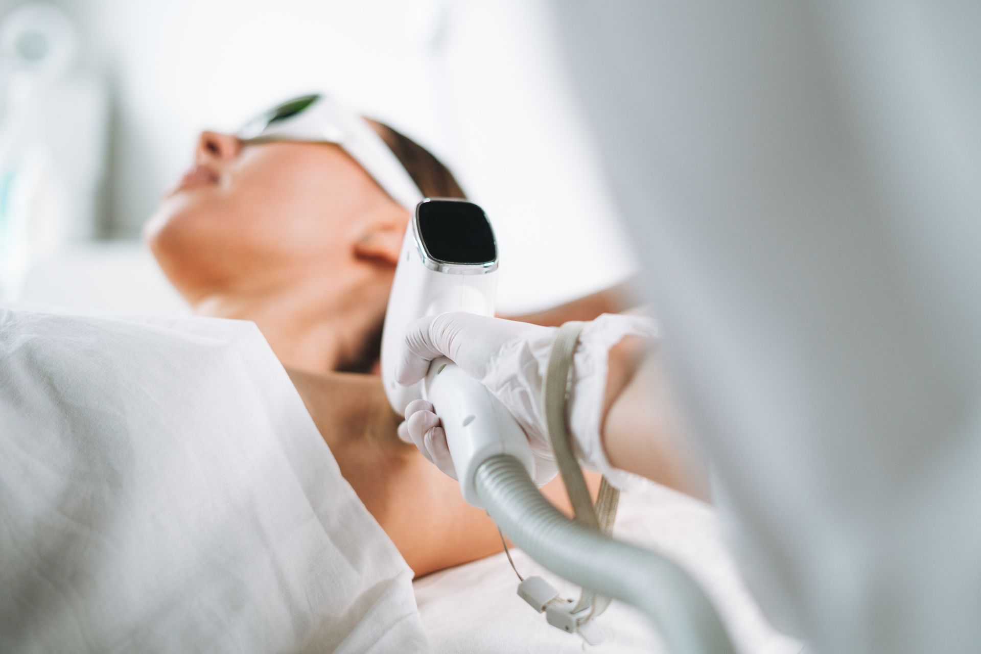 Una donna si sta sottoponendo a un trattamento di epilazione laser sulle ascelle.