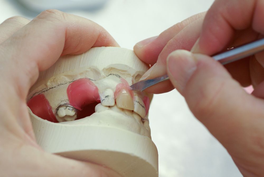 A Close-up Of A Dental Implant - Denture Clinic in Southern Highlands, NSW