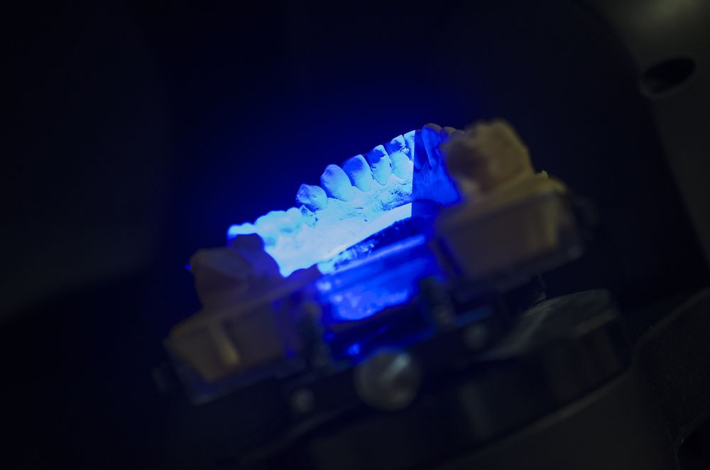 Modern Dental Clinic Equipment - Digital Dentures in Moss Vale, NSW