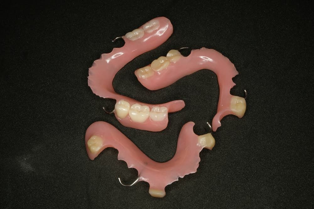 Removable Denture - Dentures in Bowral, NSW