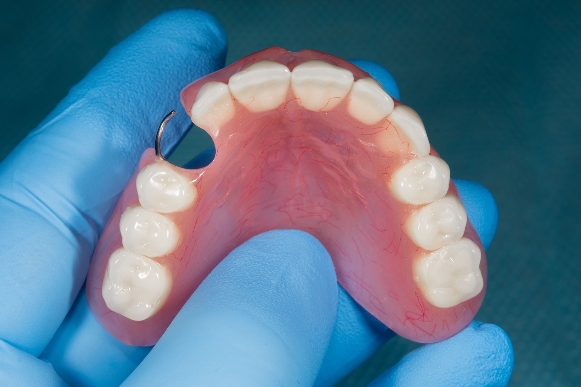 A person wearing blue gloves is holding a denture - Dentures in Lithgow, NSW