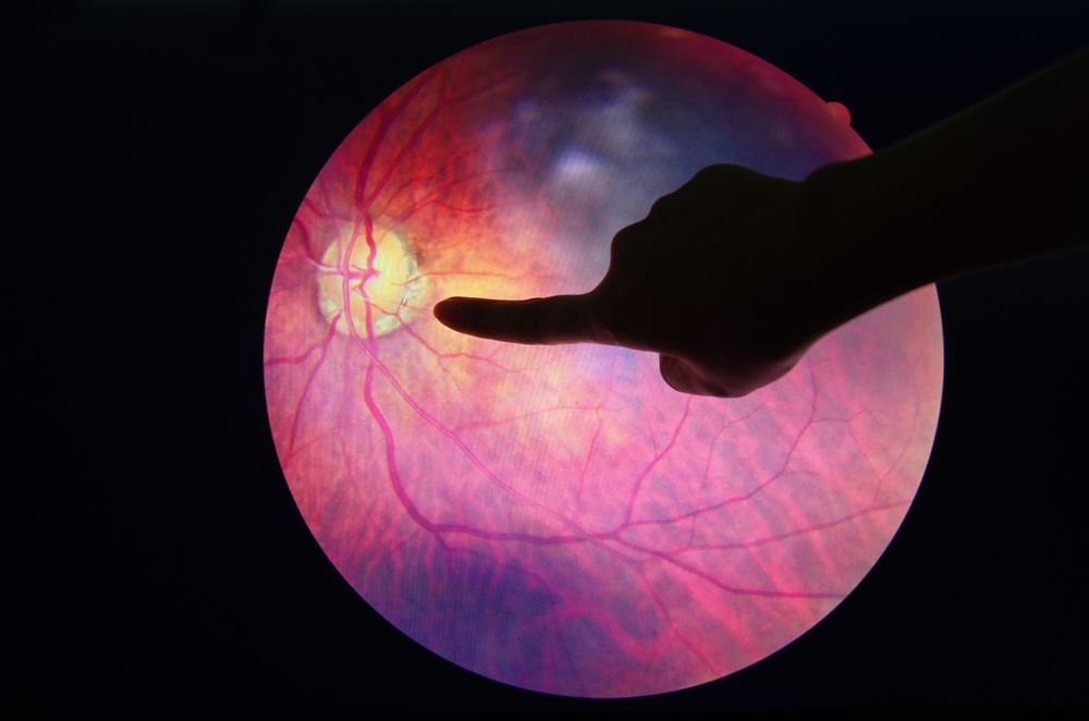 Silhouette of a Hand Pointing at a Magnified Image of a Human Retina — Michael Chu Optometrist in Cairns North, QLD
