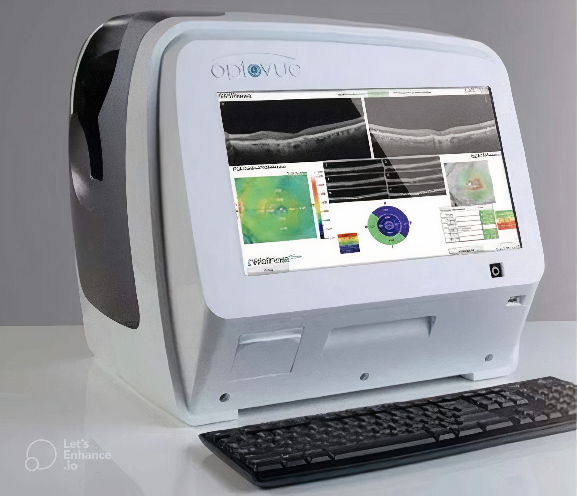 An Optovue OCT Eye Scanner Displaying Retinal Scans and Analysis — Michael Chu Optometrist in Cairns North, QLD