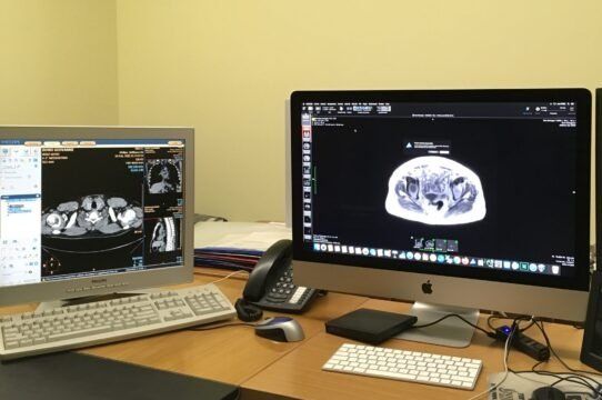 Computer per radiologia
