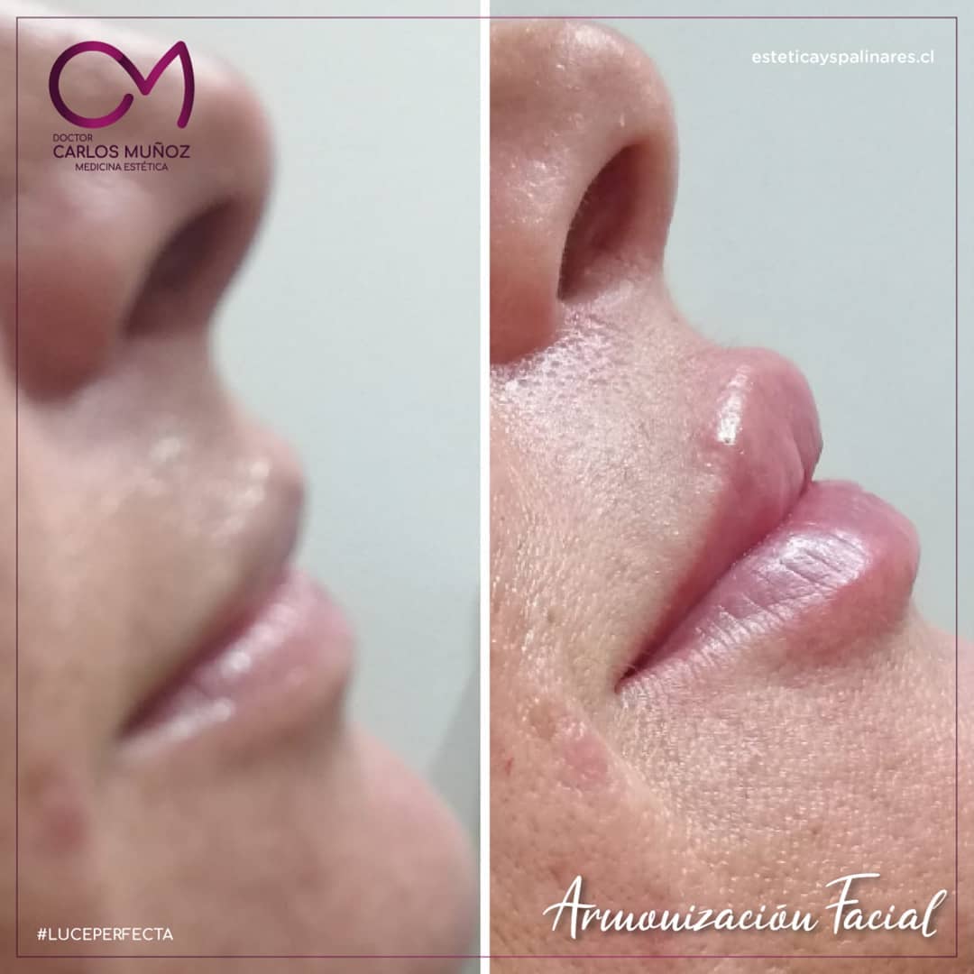 Dr. Carlos Muñoz Medicina estética