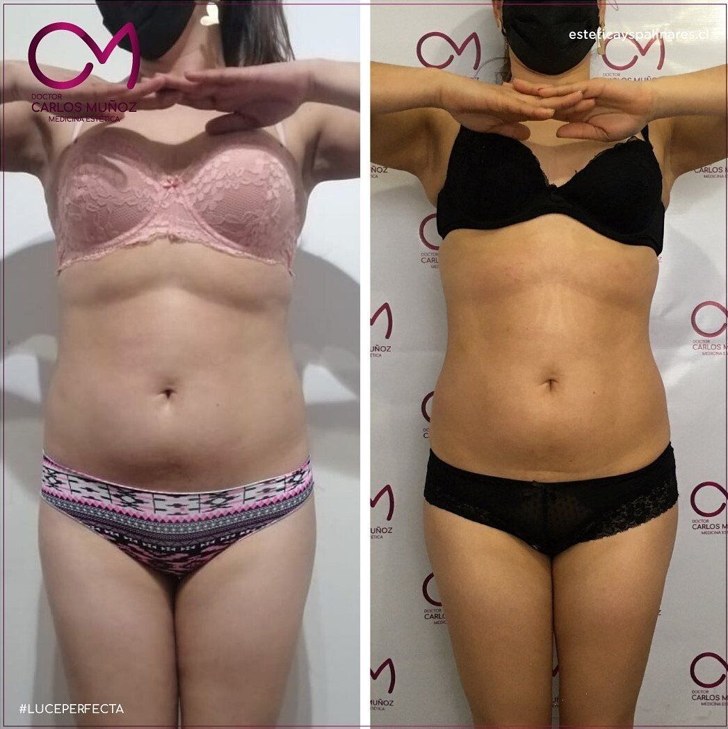 Dr. Carlos Muñoz Medicina estética