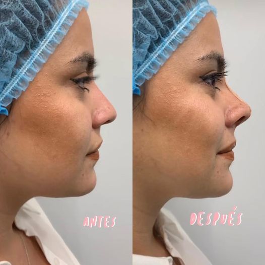 Dr. Carlos Muñoz Medicina estética