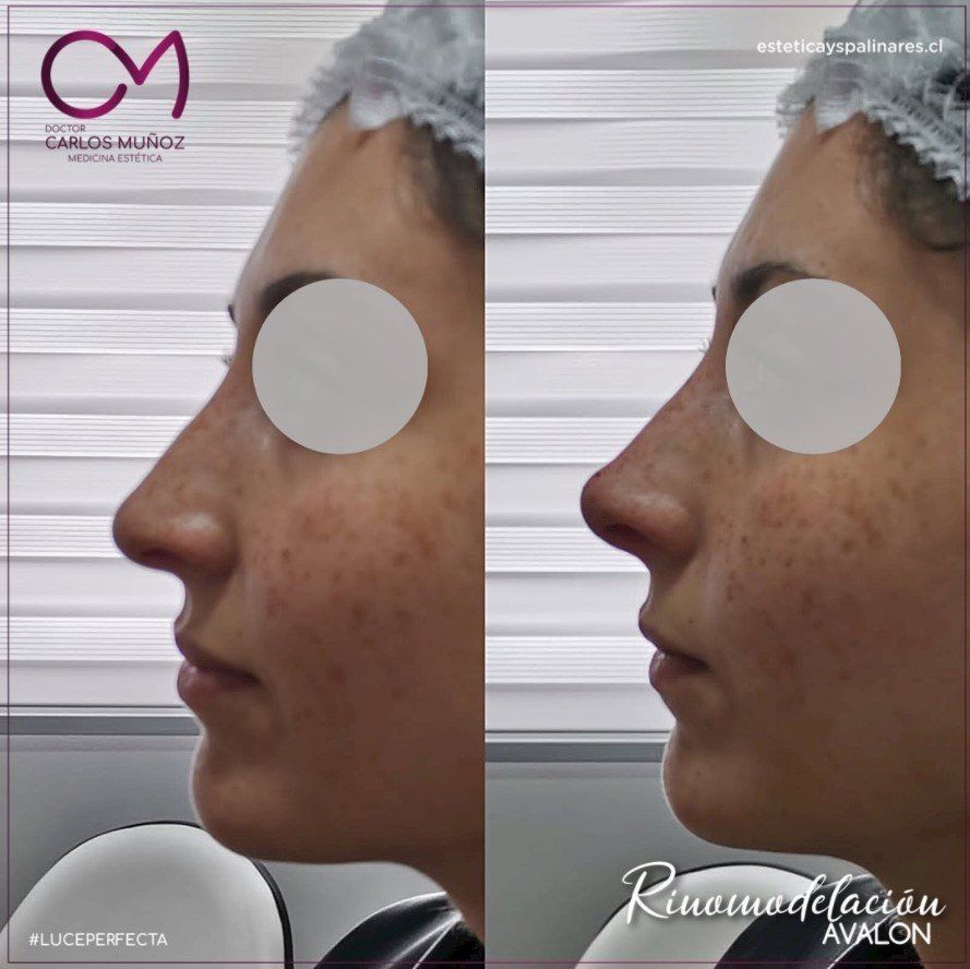 Dr. Carlos Muñoz Medicina estética