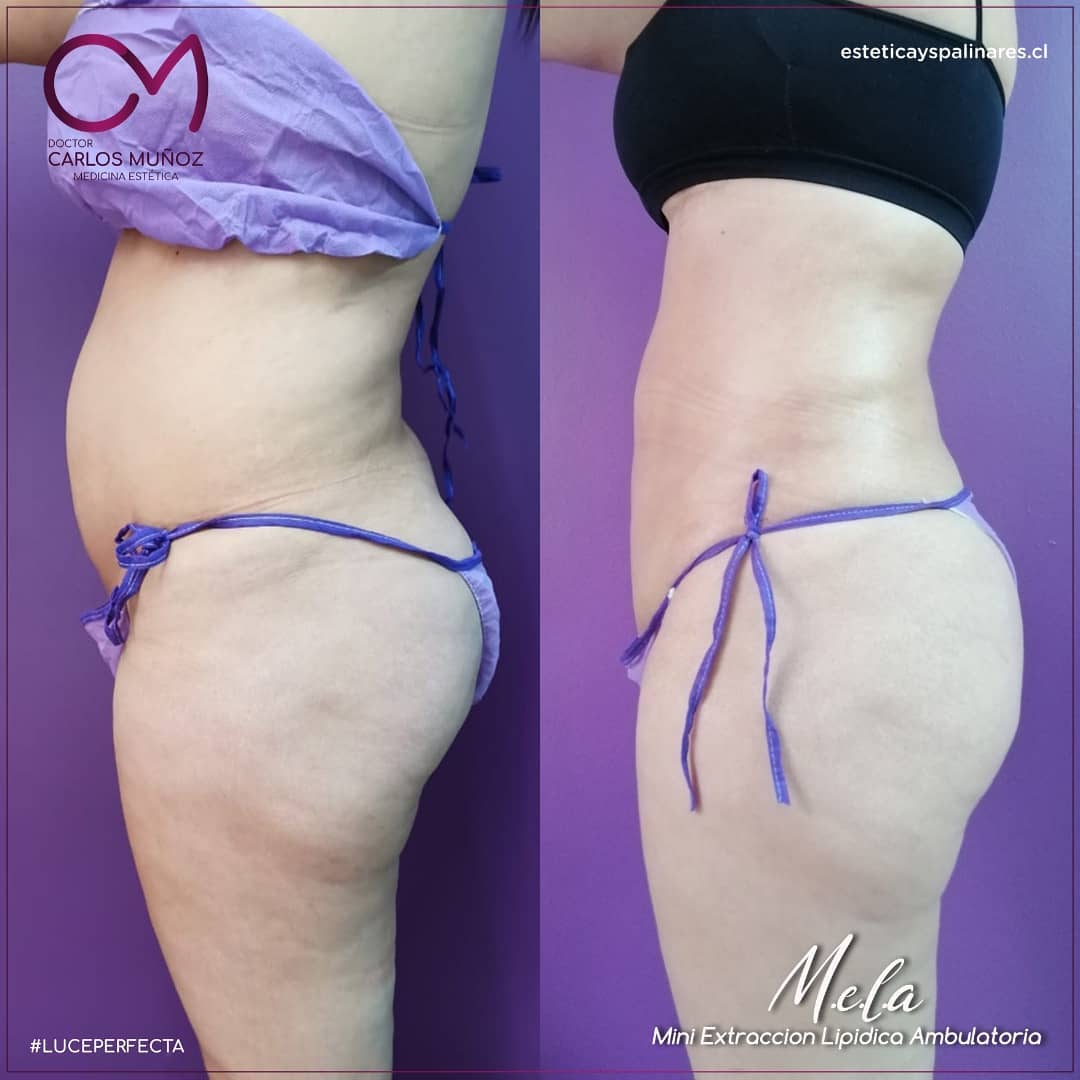 Dr. Carlos Muñoz Medicina estética